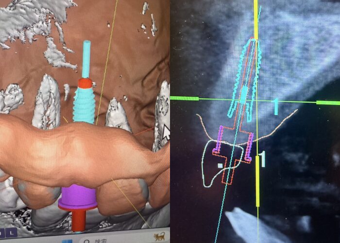 当社でのガイド設計